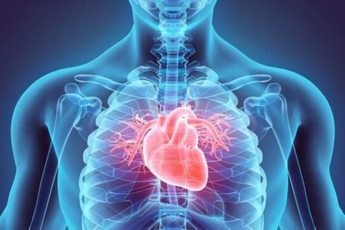 Qu’est-ce que la maladie cardiovasculaire ?