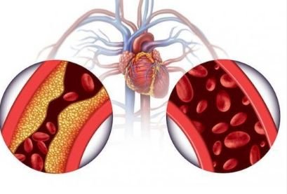 L’hypertension artérielle peut affecter la vie sexuelle