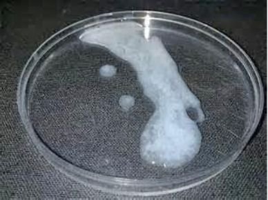 sperme aqueux