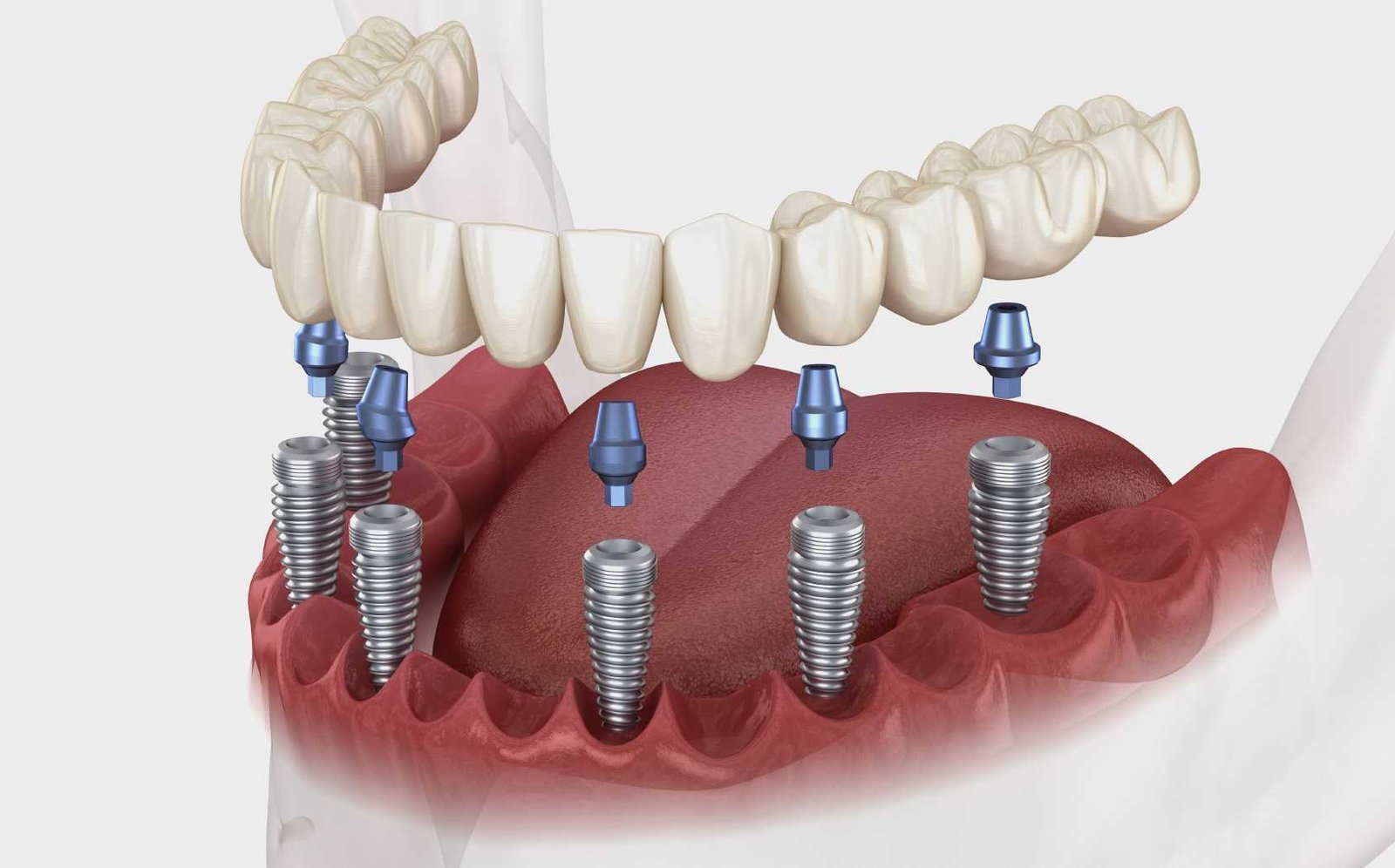 Strasbourg : guide pratique pour gérer une urgence dentaire