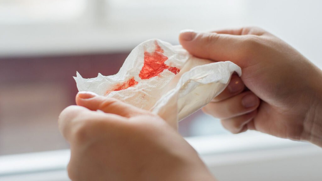 Sang dans les Selles