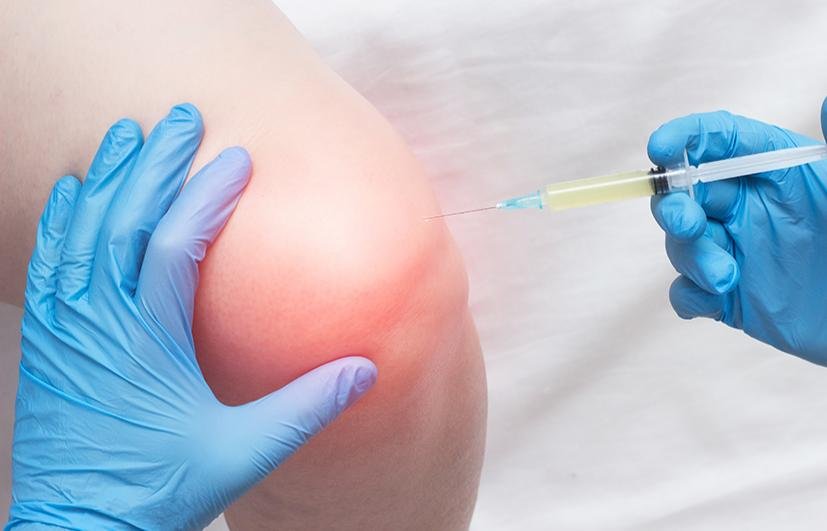 infiltration du genou